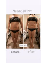 トランキーロ(Tranquilo)/痩身120分×週1回ペース　10回目