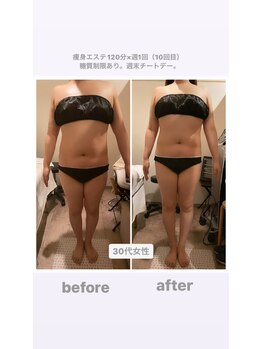 トランキーロ(Tranquilo)/痩身120分×週1回ペース　10回目