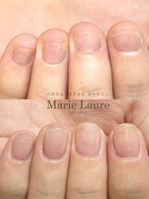 マリーロール 淀屋橋本店(Marie Laure)/自爪育成/深爪矯正/ネイルケア