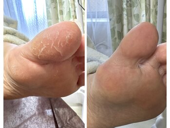 ボンド(The bond)/引っかかり痛かった問題も解消♪