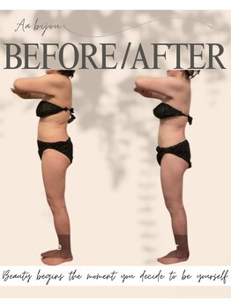 エイエービジュー(Aa.bijou)/