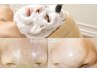 【夏にオススメ】いちご鼻・毛穴の開きに！つるんと陶器肌フェイシャル