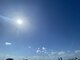 亮月堂の写真/当院独自の指圧により、首、肩、背中の痛みを改善し、リンパ血流の流れを促進◎疲労の蓄積を解消します。