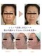 エテル(eter)の写真/【長年のしみシワ改善】皮膚の専門機関から生まれたエクスビアンス水光ピールで透明感のあるうるツヤ肌へ