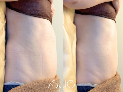 スー(Sue)の写真