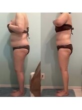 グラン(GRAN)/ぽっこりお腹撃退