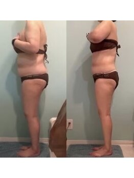 グラン(GRAN)/ぽっこりお腹撃退