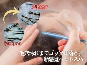 スーパースカルプ 大津店(SuperScalp)/自慢の高水圧洗浄付きヘッドスパ