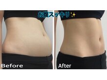 セラビシャン/before→after【お腹】