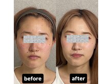 カラーウィズ(ColorWiz.)/Before→After