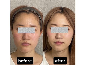 カラーウィズ(ColorWiz.)/Before→After