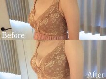 ジョリー(Jolie)/