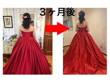 まもる整体サロン 新山口店/20代　今までで1番美しく！