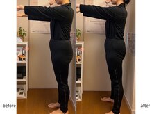 ヨサパーク 新百合ヶ丘店(YOSA PARK)/【before&after】