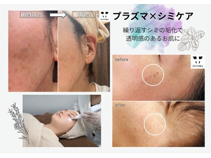 コル(COR)の写真