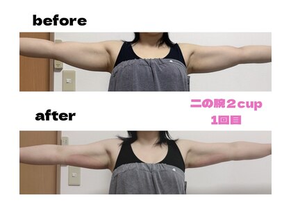 ルナ(LUNA)の写真