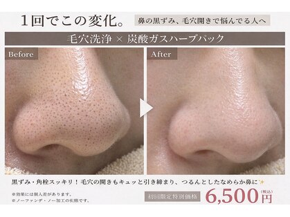 エクロール リ スキン(Eclore_re:skin)の写真