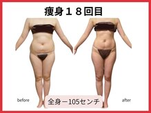 ルビー(RUBY)の雰囲気（本格痩身！最新痩身機セルゼロ２今なら全身9900円）