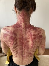 りふ/グアサー(カッサ)の様子。