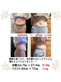 シオン/40代女性　Before&After