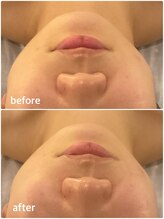 ワッカスタンド(〇 STAND)/レモンボトルエアショット