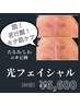 【美肌ケアで清潔感アップ】光フェイシャル　¥6,600