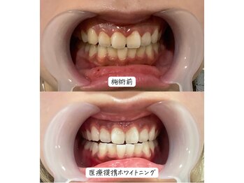 セルフメイド 東大阪店(SELFMADE)/医療提携ホワイトニング♪