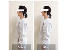 ラニ(Lani)/小顔美人整顔