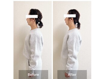 ラニ(Lani)/小顔美人整顔