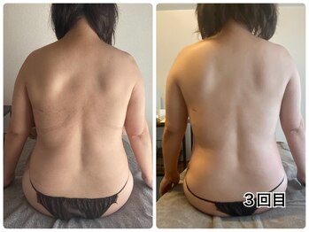 ナイスデイ(Niceday!)/背中キャビ