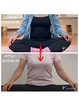 ラヴィソント(ravissant)/レッスン/ビフォーアフター/30代