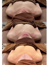 ロココ 豊田店(Rococo)/ビフォーアフター