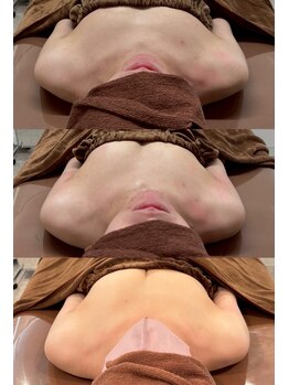 ロココ 豊田店(Rococo)/ビフォーアフター