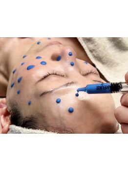 美白ケアをしたい