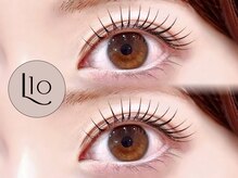 リステン プラス(Lis 10+)