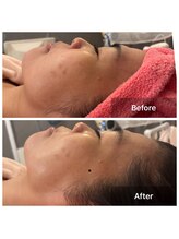 サロンドデュイ/1回施術/50代/エステ四日市