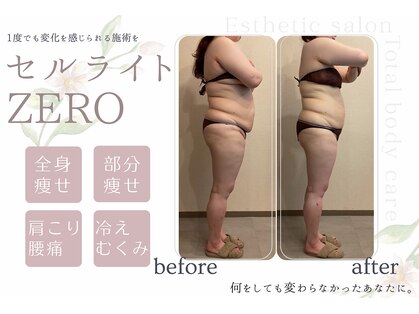 ナチュールファースト(naturel first)の写真