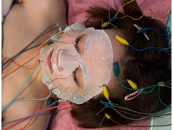 さくら鍼灸院 整骨院の写真/定期ケアでホウレイ線/たるみを予防!エイジングケアに最適☆【美容鍼+幹細胞パック+小顔エステ60分¥5000】