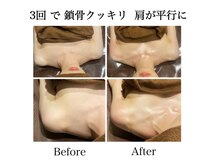 ナチュラーレ 天王寺店(Naturale)/痩身リンパマッサージ二の腕美脚
