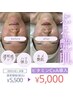 【7月限定】シミ・くすみケア★透明感UPビタミンCフェイシャル¥6,500→¥5,500
