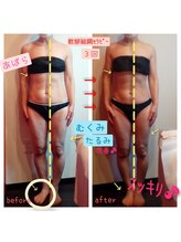 ビューティサロン キヨの部屋(beauty salon)/【軟部組織セラピー】　３回