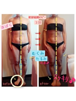 ビューティサロン キヨの部屋(beauty salon)/【軟部組織セラピー】　３回