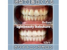 ライトビューティー 池袋店(LightBeauty)/症例写真