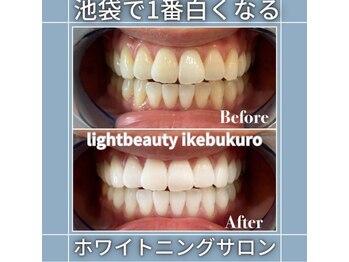 ライトビューティー 池袋店(LightBeauty)/症例写真