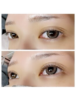 アアルズ(R’s)/