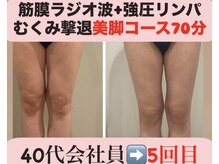 マール(Mar)/ビフォーアフター痩身/骨格矯正