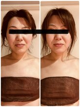 ハピネスエグゼ/６０分一度のビフォーアフター