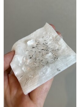 ニコ(Nico)/ヒゲ脱毛