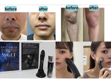 ファイブ トゥー(Five Two)の雰囲気（スタッフが効果を体験済み！セルフ美顔器もおすすめです！）