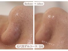 カモラス(CAMOLUS)の雰囲気（毛穴黒ずみお悩み解決！毛穴引き締めて潤艶肌へ◎守山/高蔵寺）